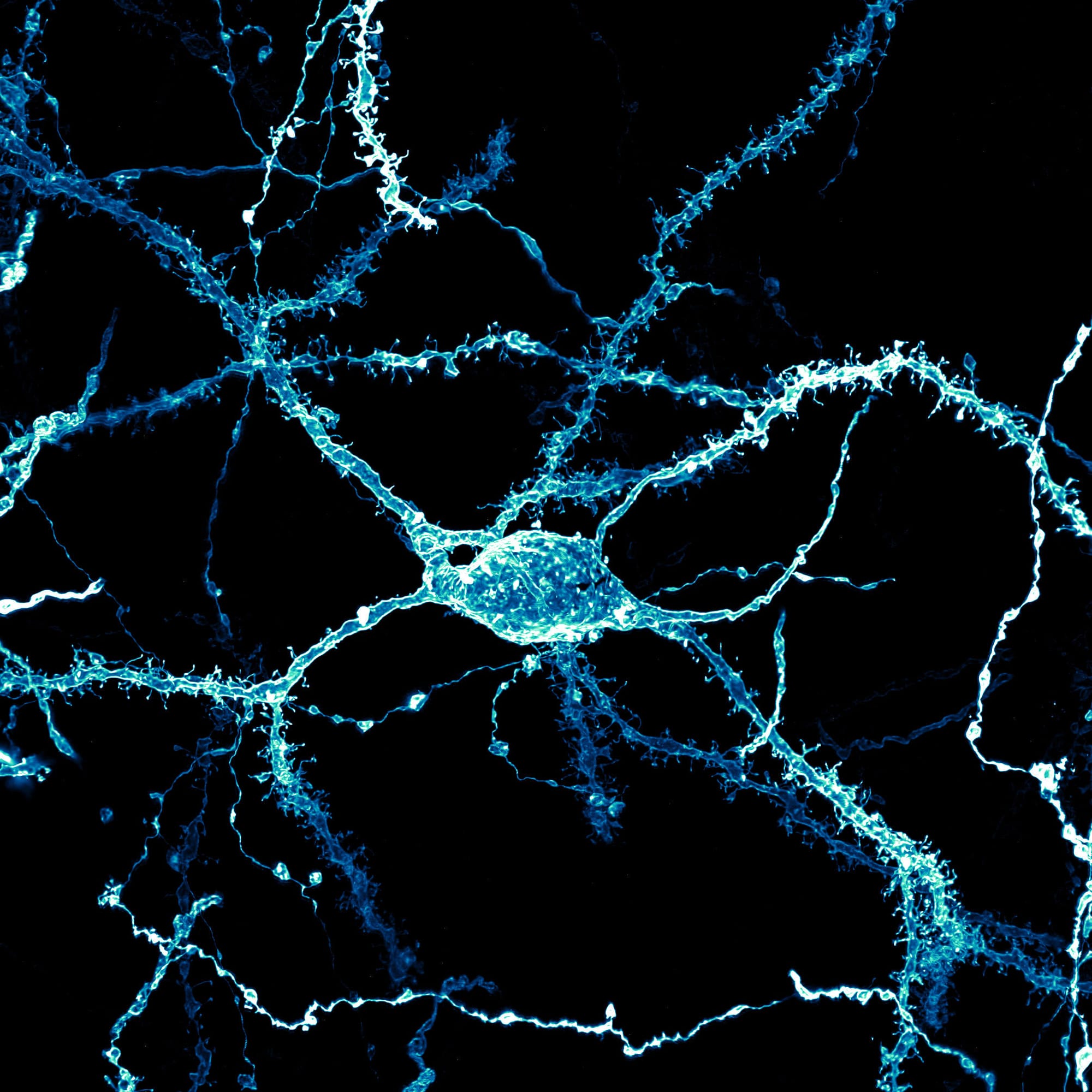 Neuronal Trauma, Dendritic Spines, Autism and Vaccines: A Clear Biological Pathway For Harm