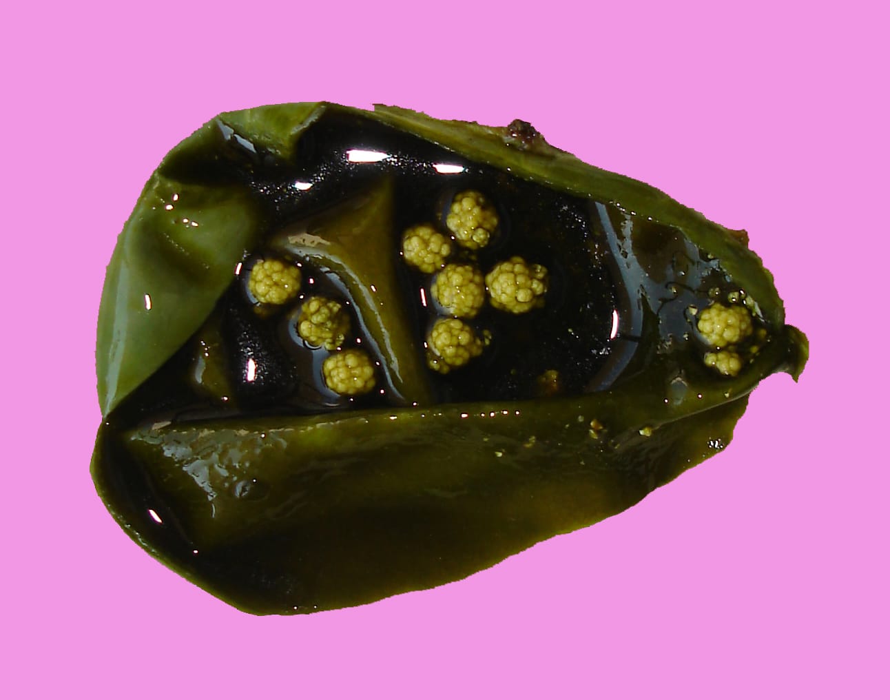 Pathology: See What Disease Looks Like On The Inside