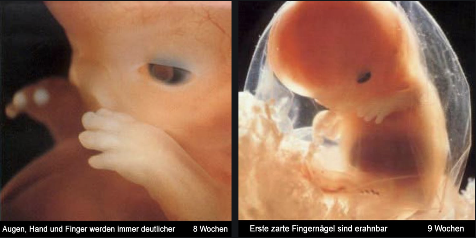 Human Fetal Development